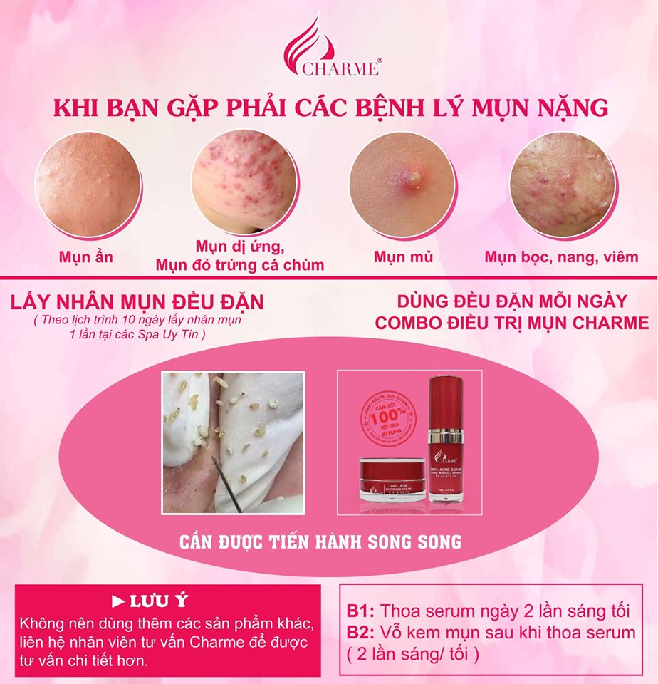 Combo Ngừa Mụn Trắng Da Charme Hàn Quốc