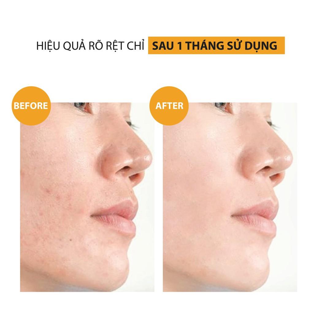 Serum Trắng Da Vitamin C Dưỡng Sáng, Mờ Thâm Bổ Sung HA & Collagen MILAGANICS 10ml