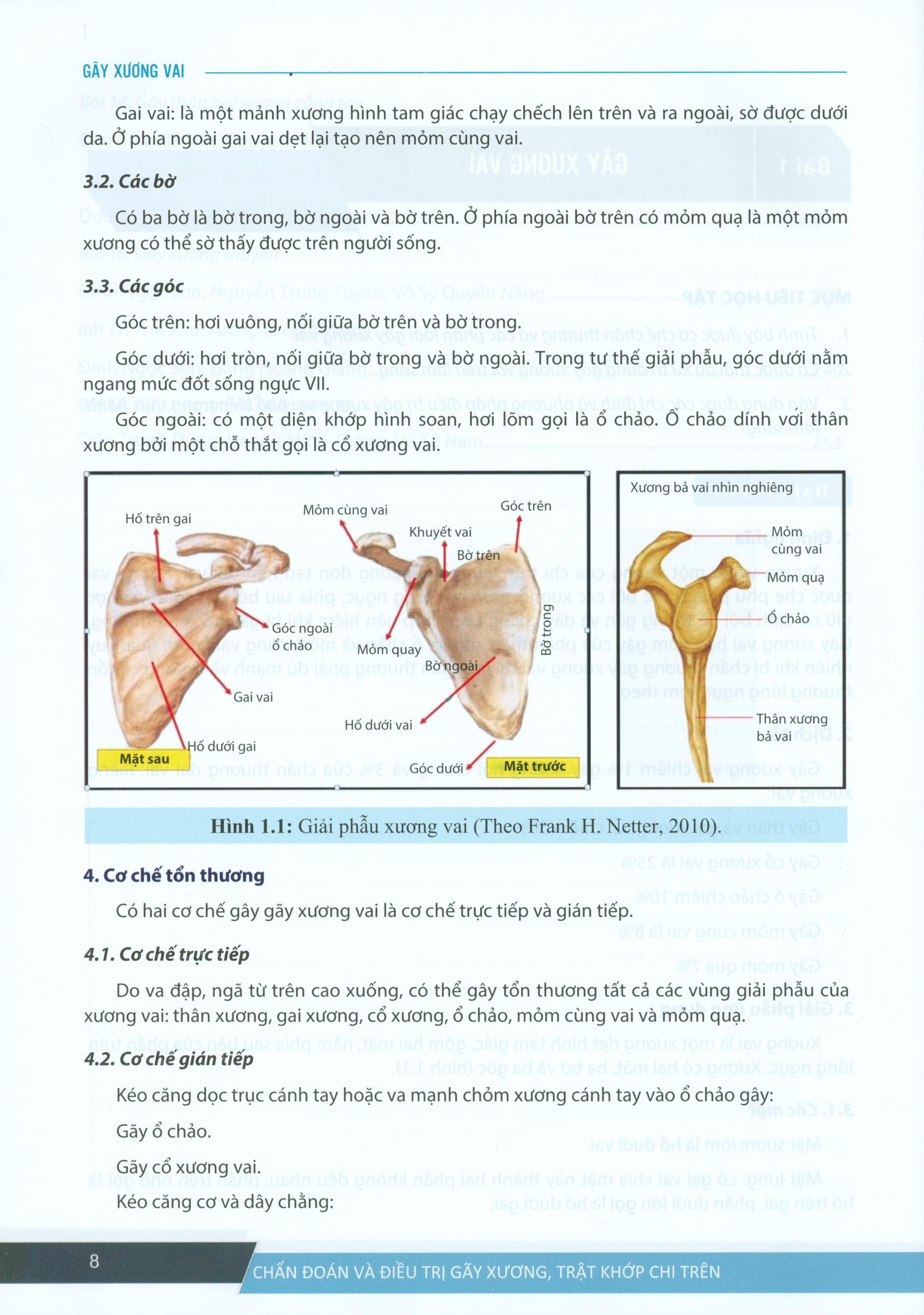 Chẩn Đoán Và Điều Trị Gãy Xương Trật Khớp Chi Trên