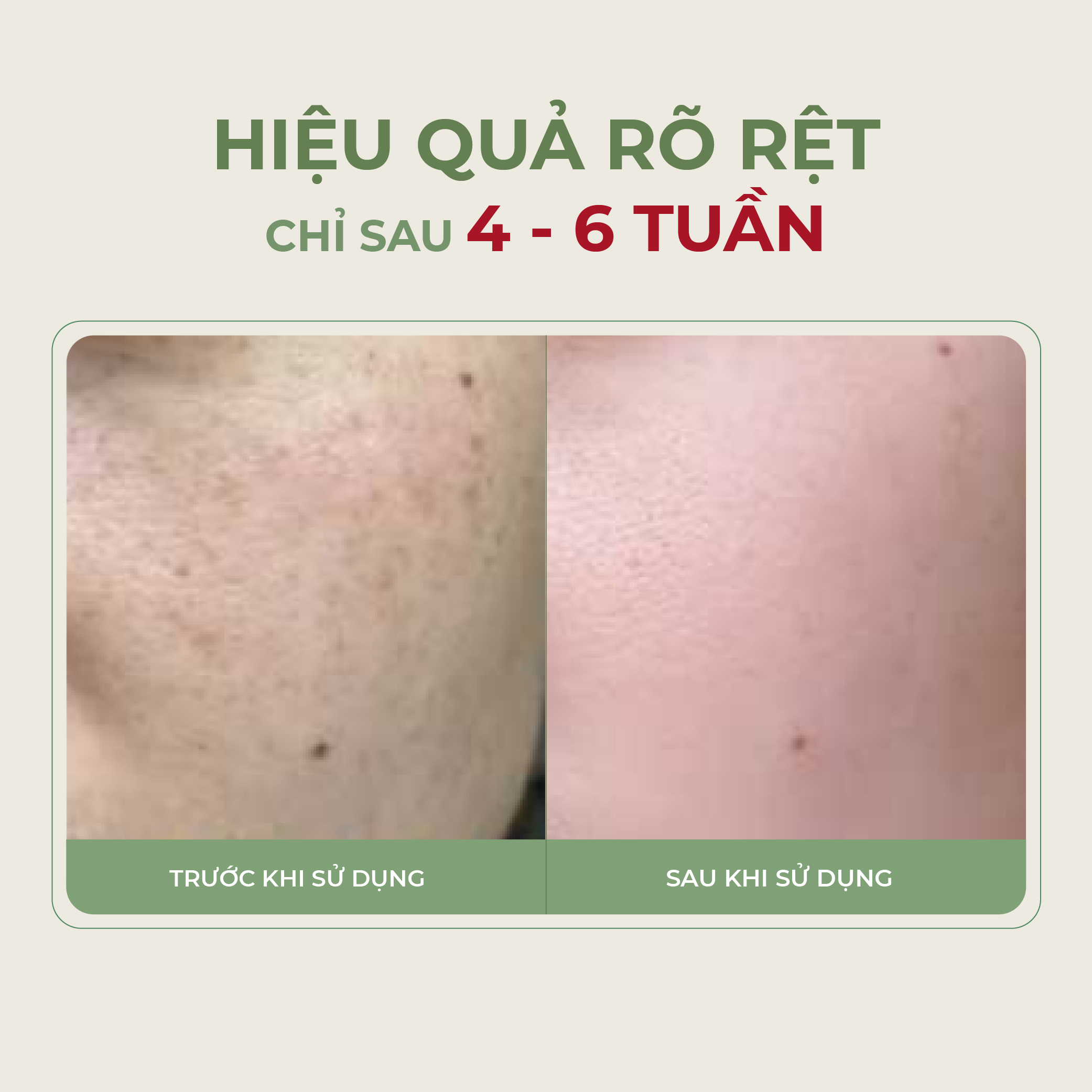 Serum Nám Da ABERA - Mờ Nám Hiệu Quả, Trắng Da Làn Da Sáng Mịn Không Tì Vết