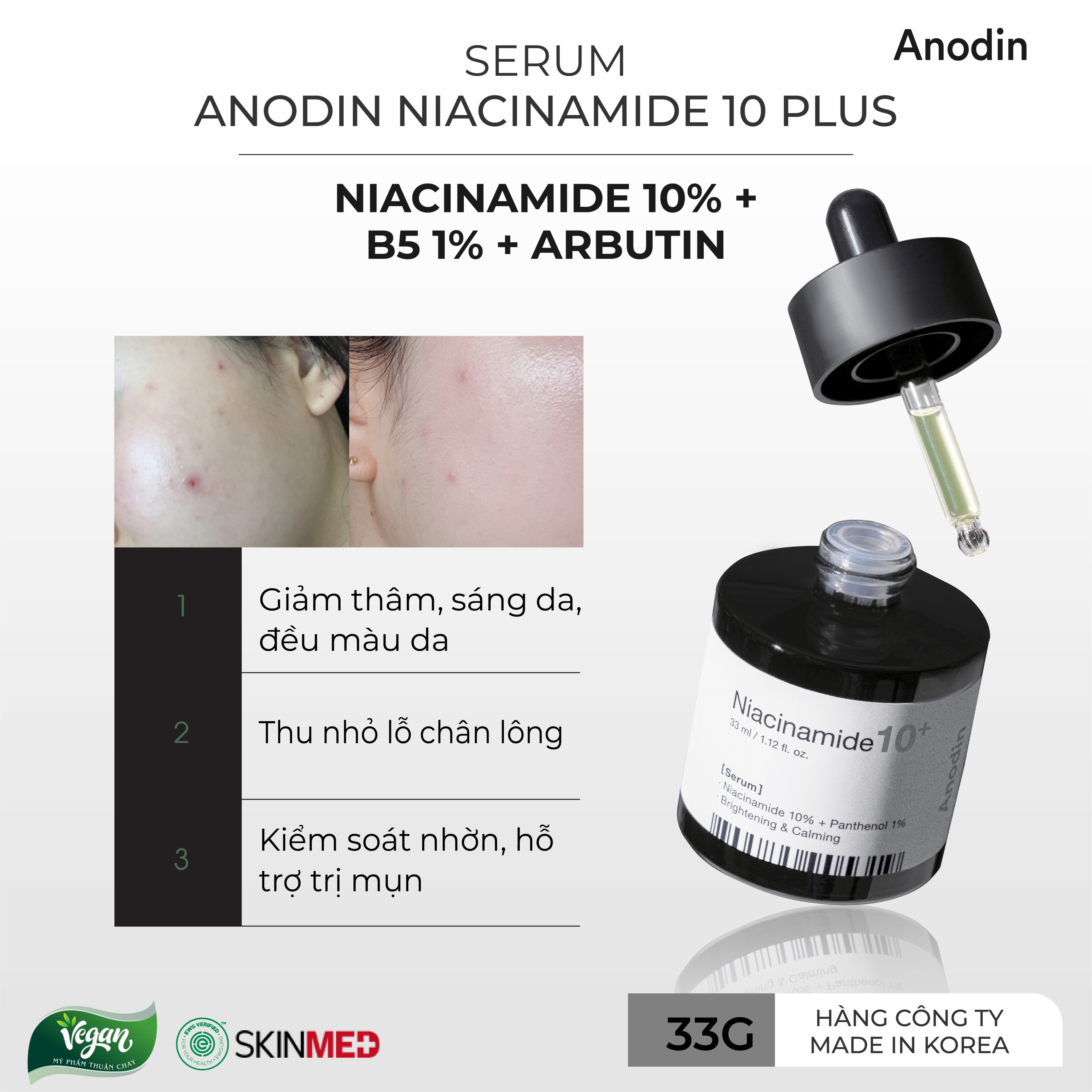 Serum làm trắng và thu nhỏ lỗ chân lông Anodin Niacinamide 10 Plus - Hàn Quốc Chính Hãng