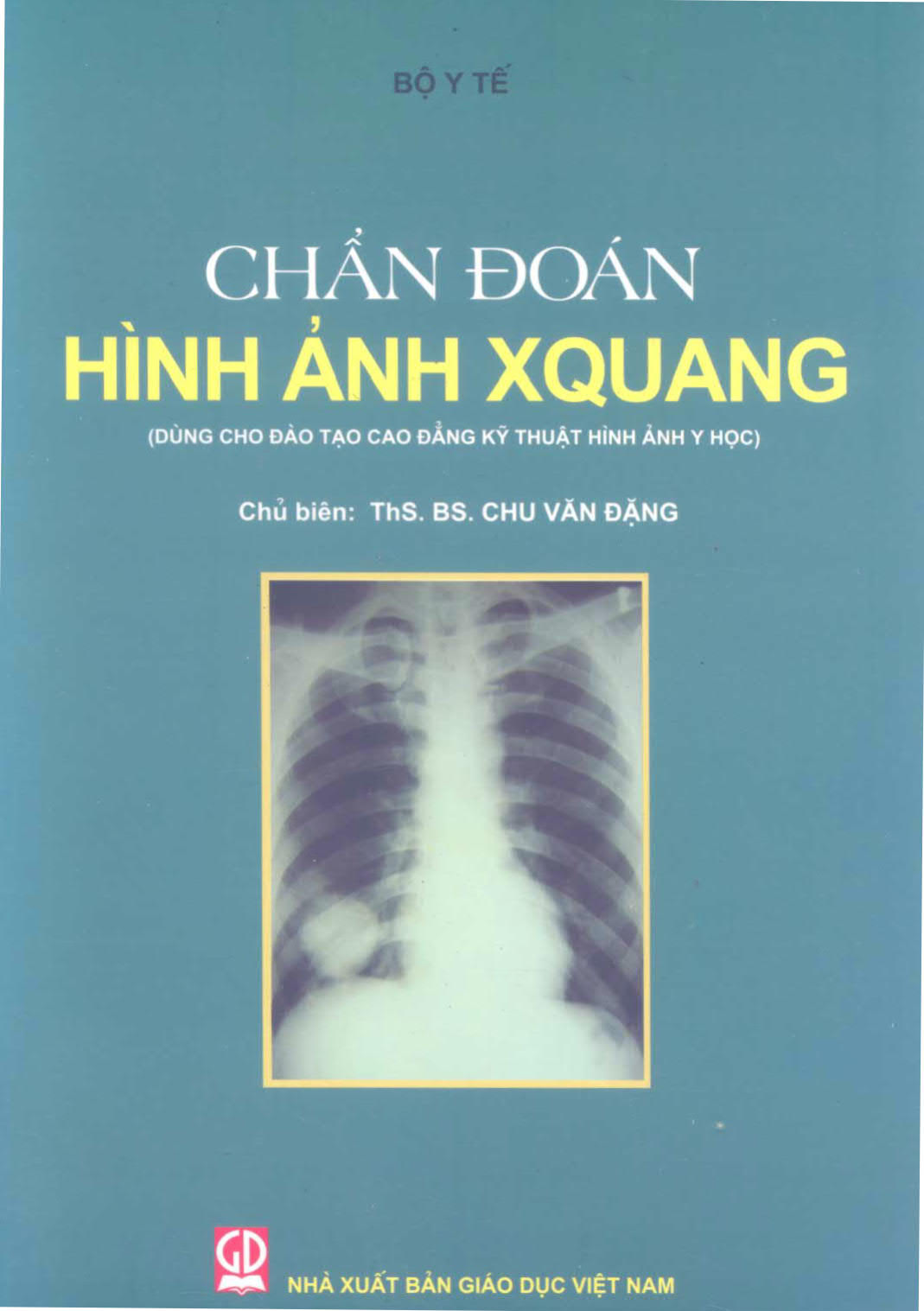 Chẩn đoán hình ảnh X quang (Dùng cho đào tạo Cao đẳng hình ảnh Y học)