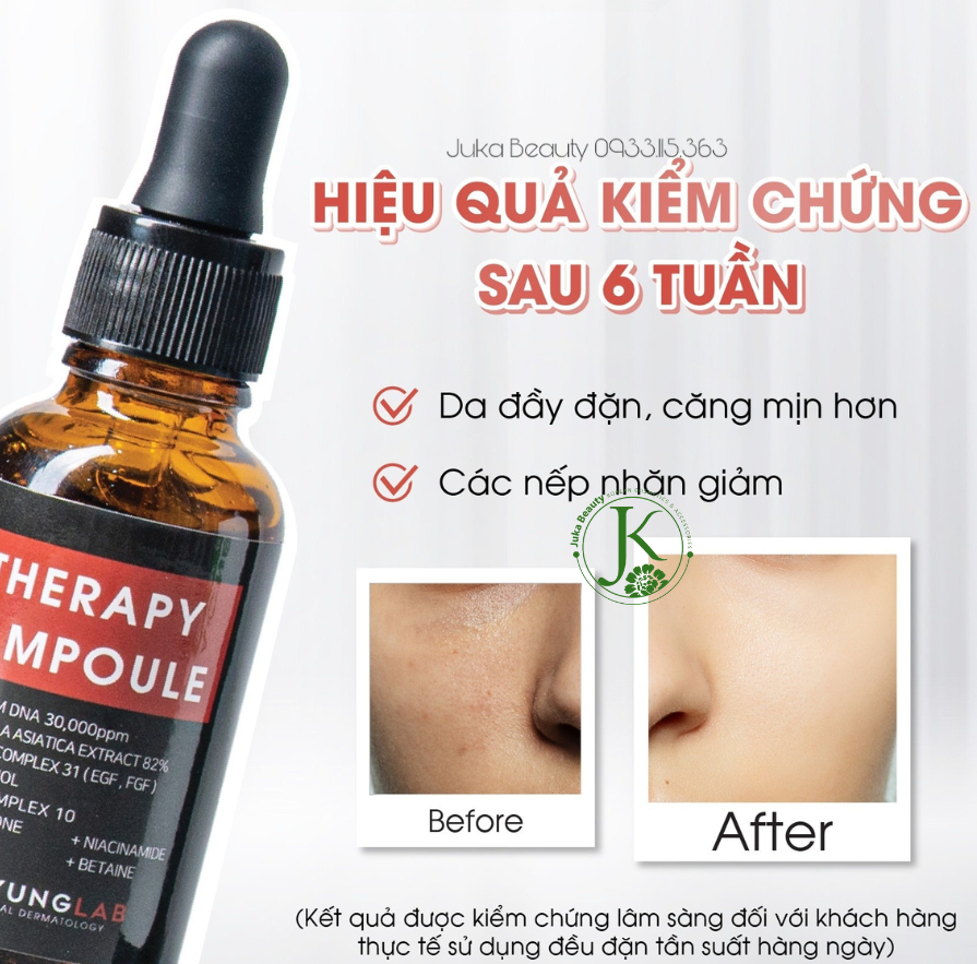 Serum trẻ hóa da Kyung Lab PDRN Therapy Ampoule 50ml - Phục hồi và nuôi dưỡng làn da
