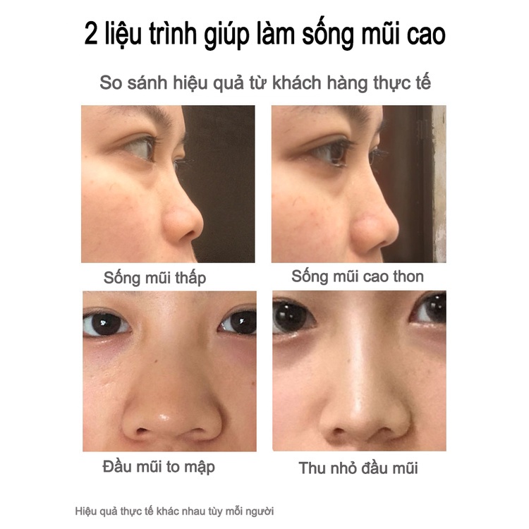 Serum cao mũi 10ml tinh dầu nâng mũi săn chắc tạo dáng mũi tăng chiều cao sống mũi