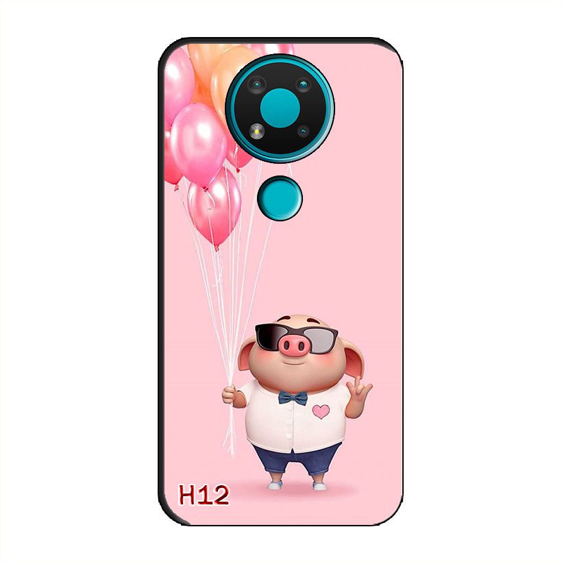 Ốp Dẻo Dành Cho NOKIA 3.4