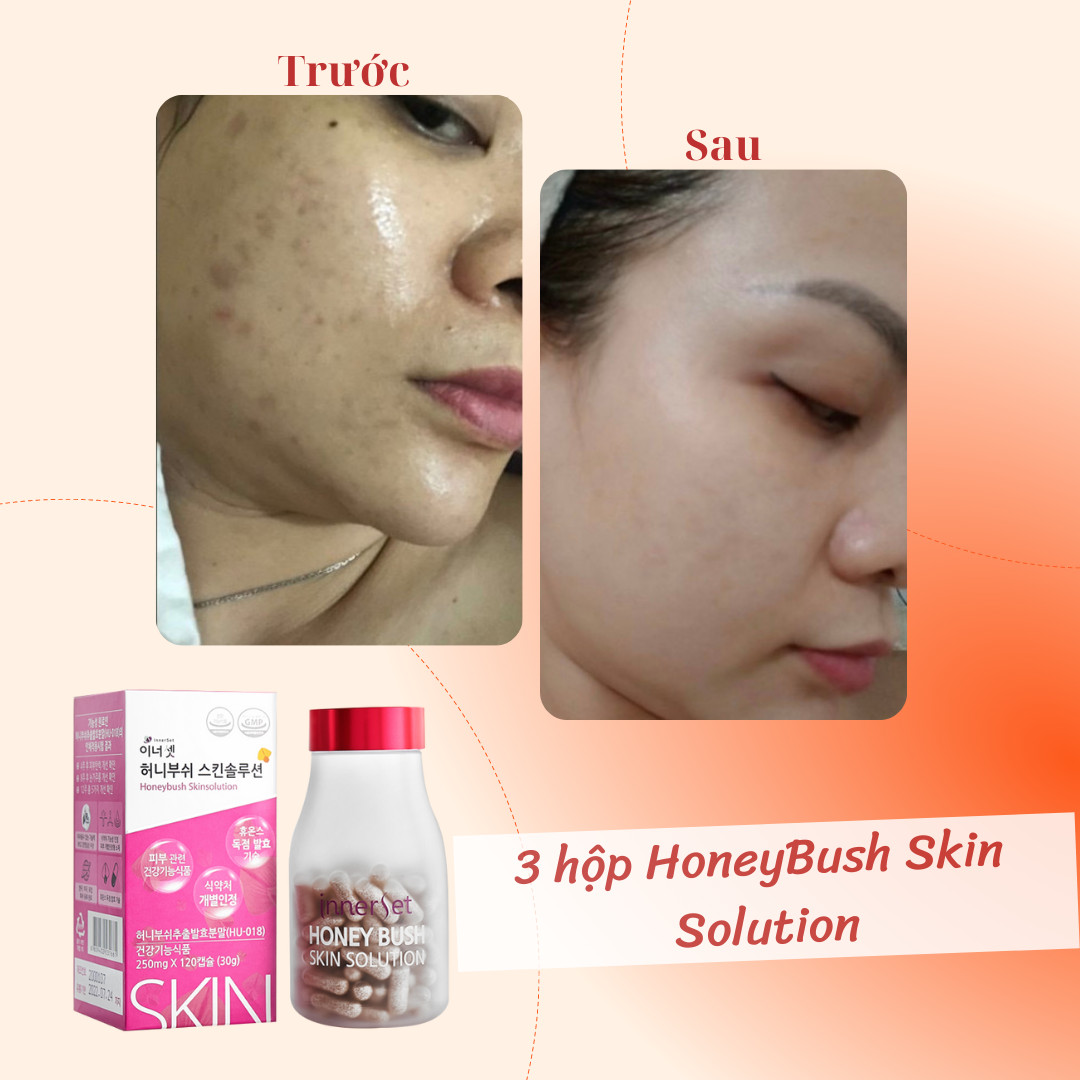 Viên uống chống nắng HoneyBush Skin Solution Hàn Quốc 120 viên