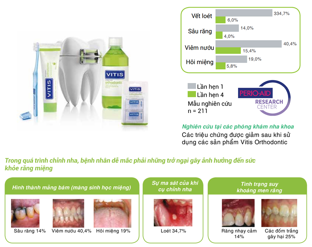 Bộ chăm sóc răng miệng mini dành cho người chỉnh nha, gắn mắc cài Vitis Orthodontic 4 món (Bàn chải + Kem đánh răng 15ml + Nước súc miệng 30ml, cây chải kẽ răng 1.3mm)