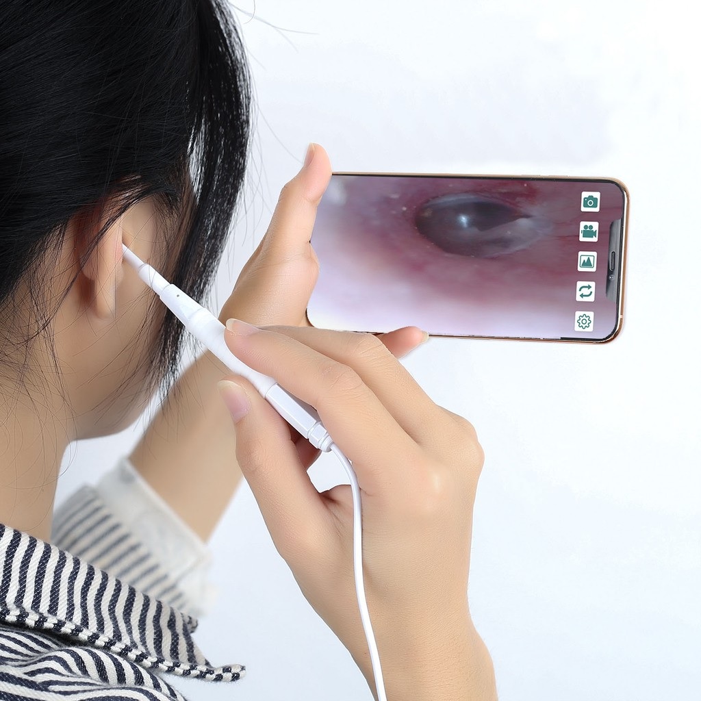 Camera Nội Soi Tai Mũi Họng Dụng Cụ Lấy Ráy Tai Đa Năng 3 Trong 1 HD Đường Kính 3.9mm Dùng Cho PC, Laptop, Android AN103 - Hàng Nhập Khẩu