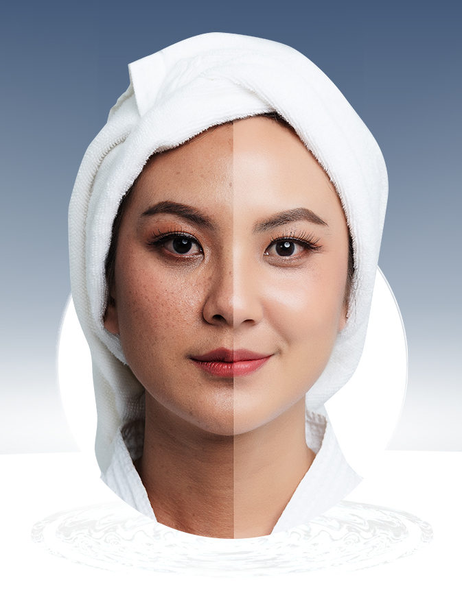 Kem Nám Tàn Nhang Hana Melasma &amp; Night Hanayuki Chính Hãng Kem Giảm Nám Mờ Thâm Dưỡng Trắng Da Mặt Ban Đêm 15g