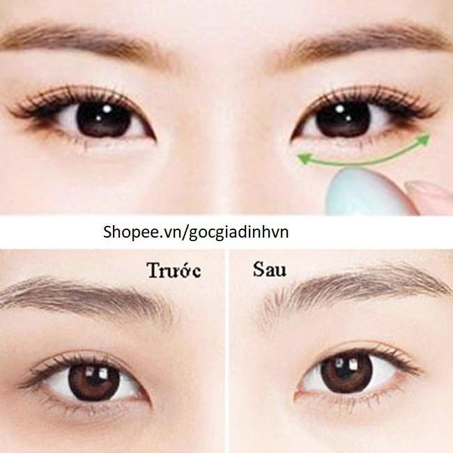 Máy massage đánh tan quầng thâm, chống bọng mắt, mụn xung quanh mắt