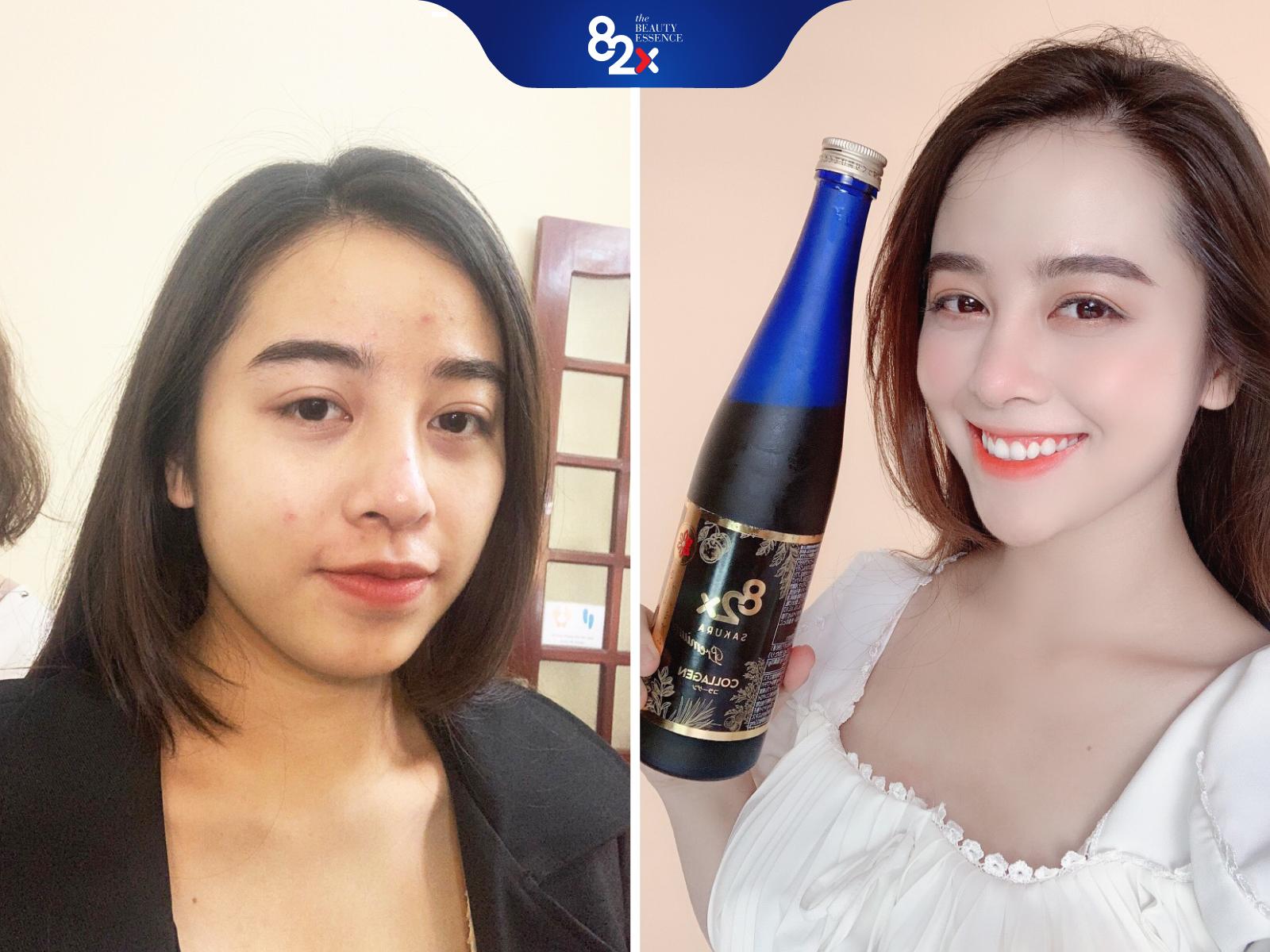 ĐẸP NÕN NÀ - DA PHỦ SƯƠNG CĂNG MƯỚT Combo 3 Chai: COLLAGEN + SAKURA COLLAGEN + SAKURA PLACENT Nước Uống Đẹp Da Nhật Bản