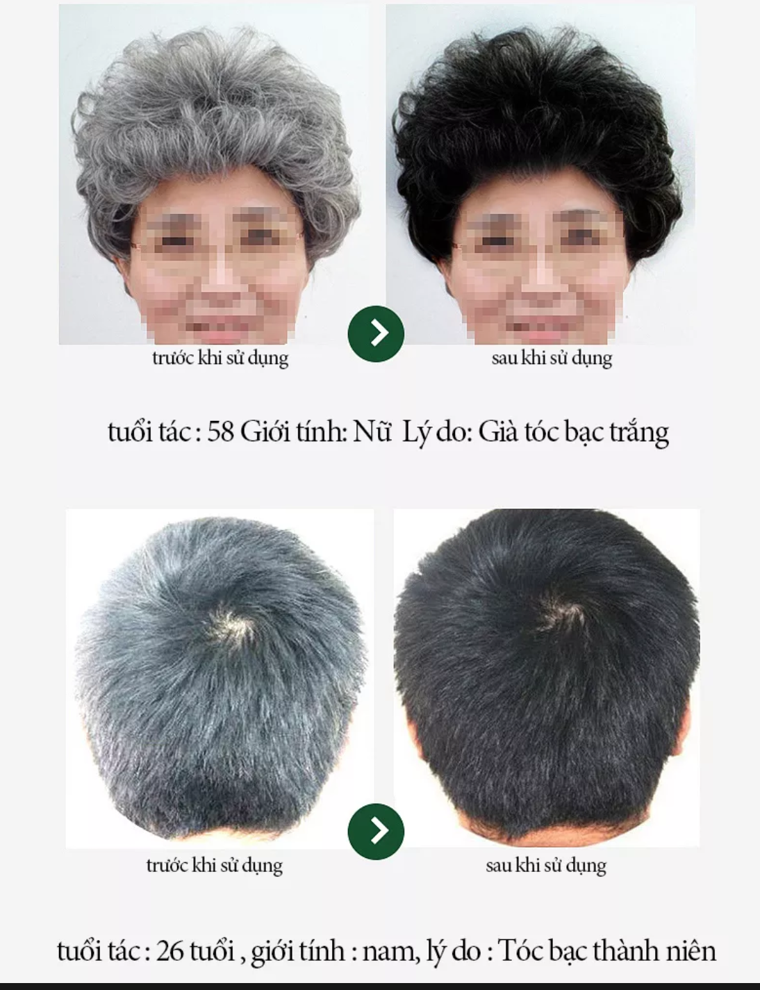 CHAI TINH DẦU XỊT LÀM TÓC ĐEN DƯỠNG TÓC TÓC TRẮNG BIẾN THÀNH TÓC ĐEN ĐẸP HÀNG CHUẨN