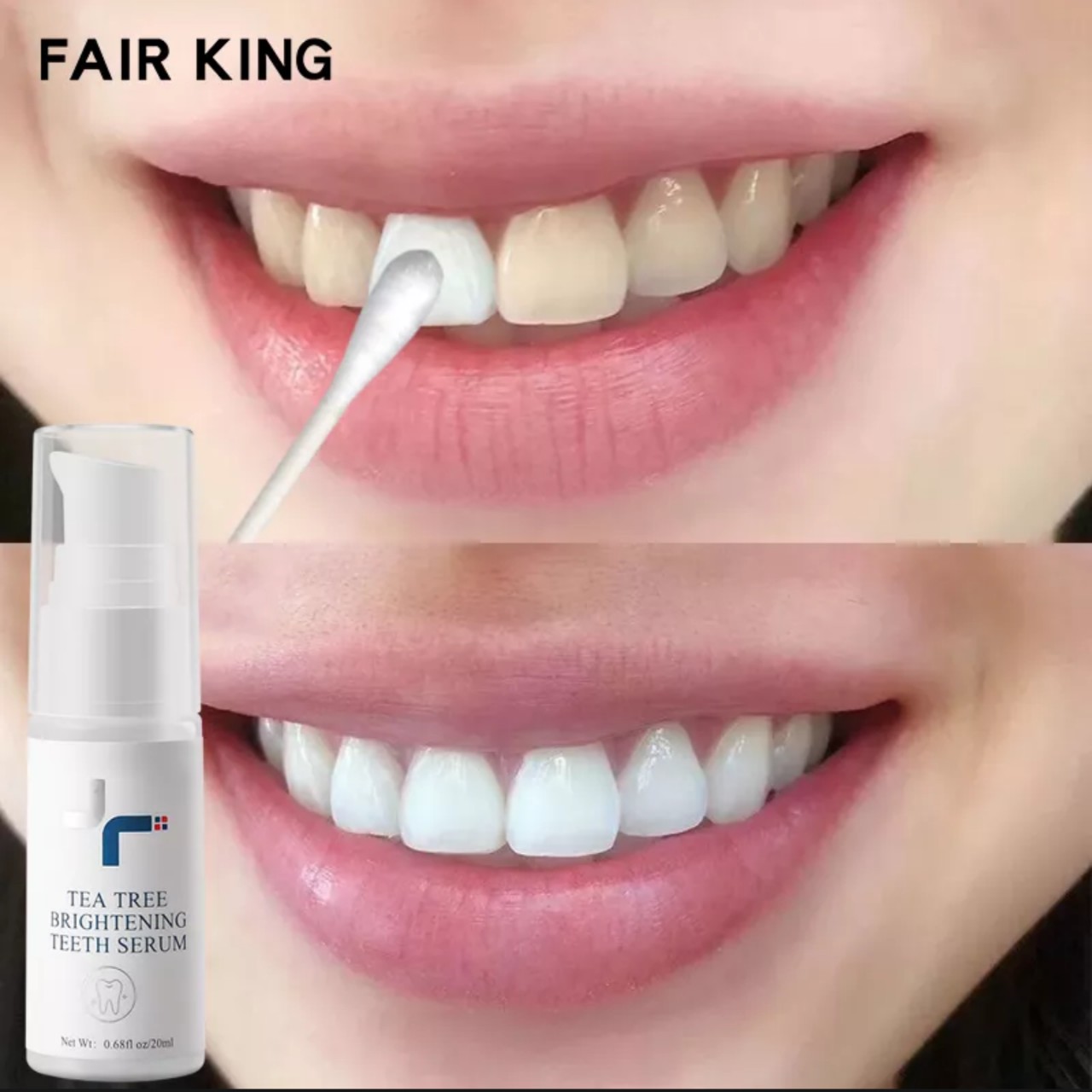 Serum tinh chất làm trắng răng loại bỏ mảng bám, vết bẩn ố vàng cho bạn hàm răng trắng sáng tinh khôi loại tốt 10ml
