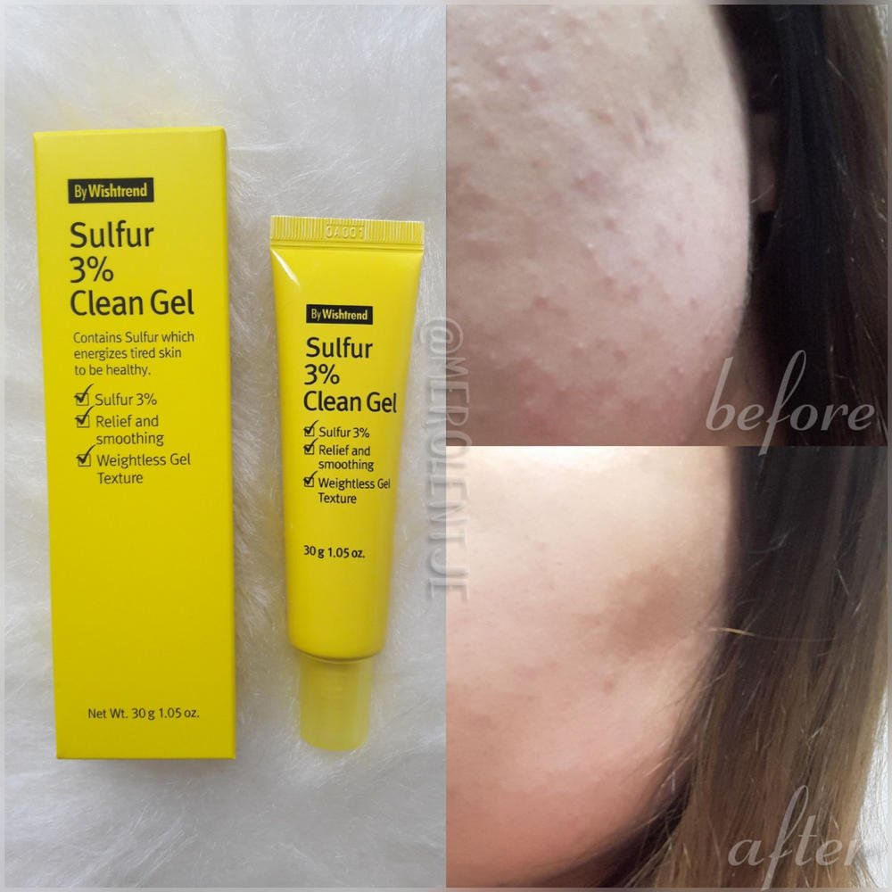 Gel hỗ trợ giảm mụn và ngăn ngừa mụn By Wishtrend Sulfur 3% Clean Gel 30g + Tặng Kèm 1 Băng Đô Tai Mèo (Màu Ngẫu Nhiên)