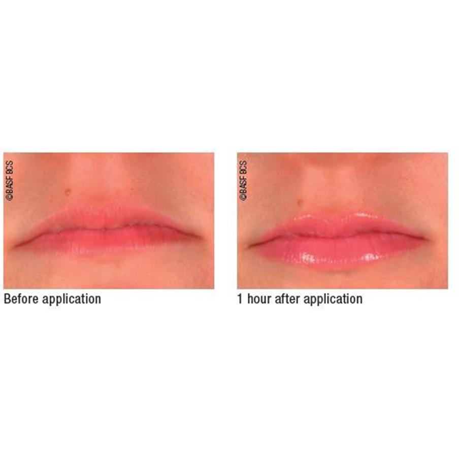 Son dưỡng làm căng đầy môi Teoxane 3D LIP 10ml