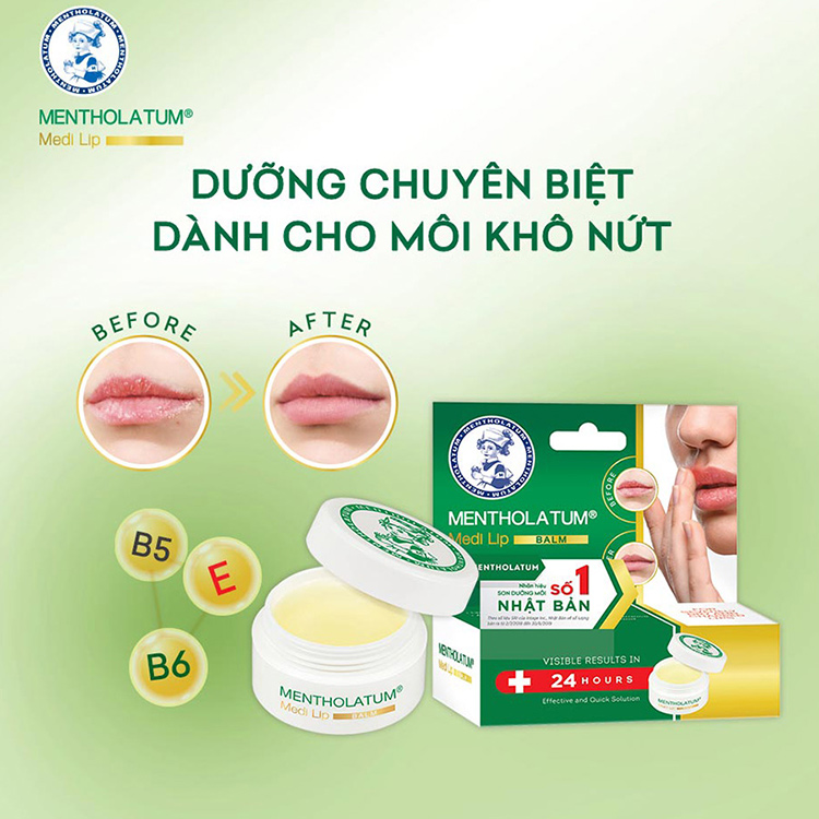 Sáp dưỡng môi chuyên biệt dành cho môi khô, nứt nẻ Mentholatum Medi Lip Balm (7g)