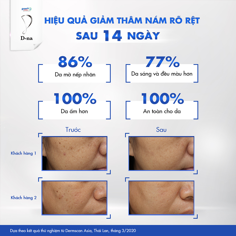 Viên uống sáng da glutathione D-na Whitening Supplement (60 Viên)