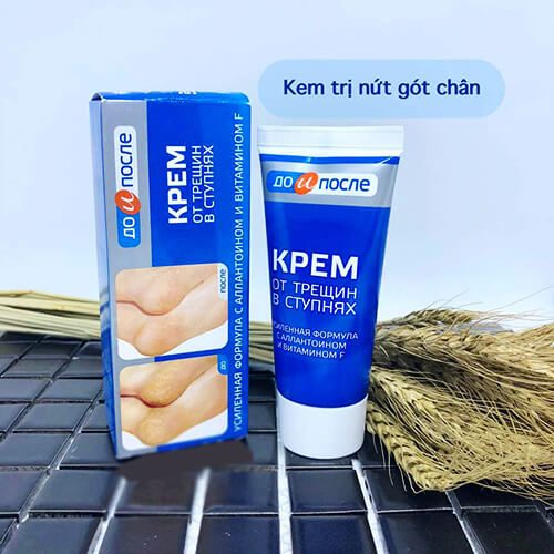 Kem giúp giảm tình trạng nứt gót chân Kpem 50ml( không xuất hóa đơn đỏ )