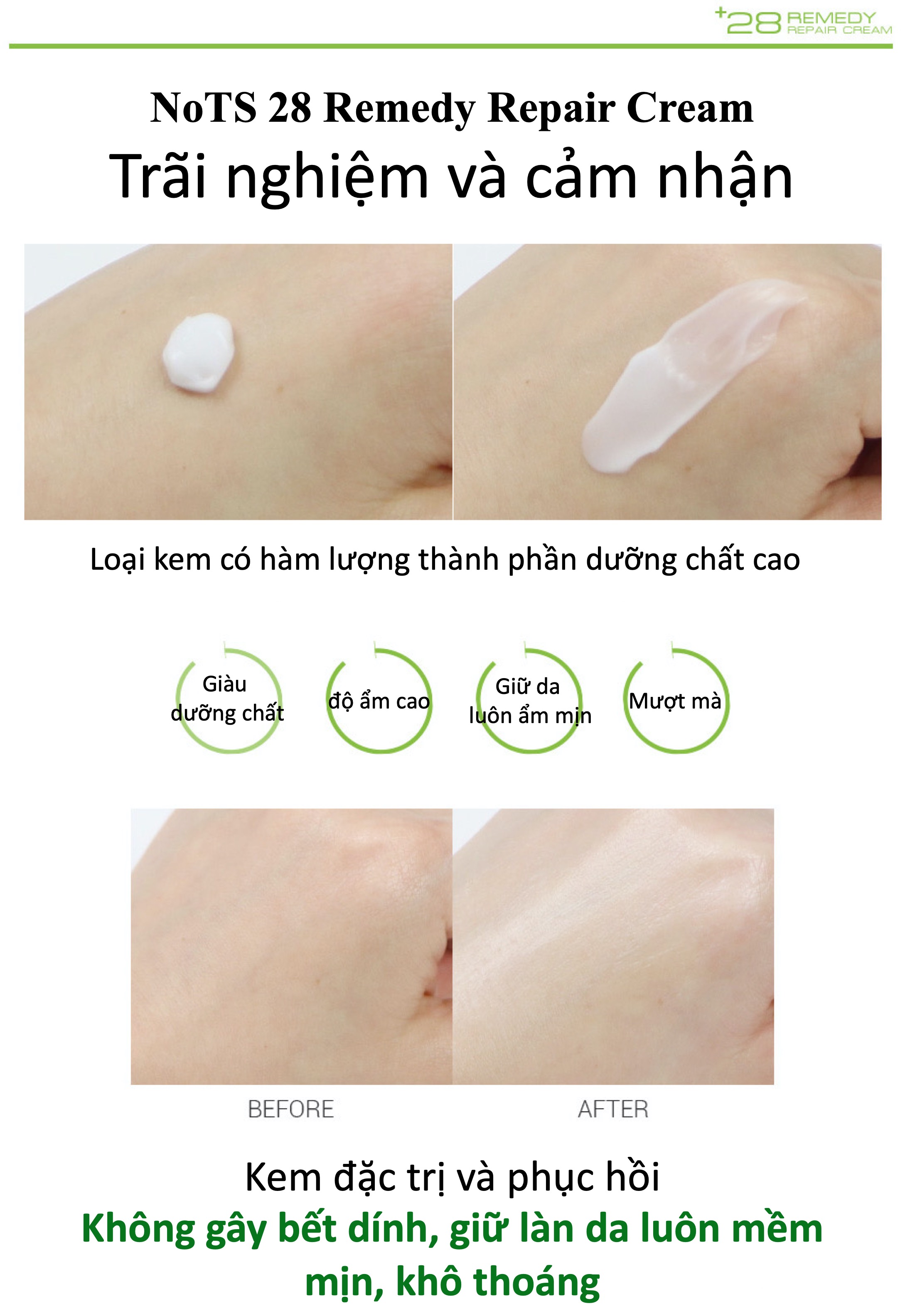 KEM DƯỠNG DA NOTS 28 REMEDY REPAIR CREAM