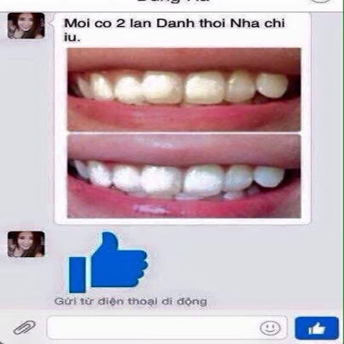 Bột tẩy trắng răng, giảm hôi miệng - Sản phẩm của Nga