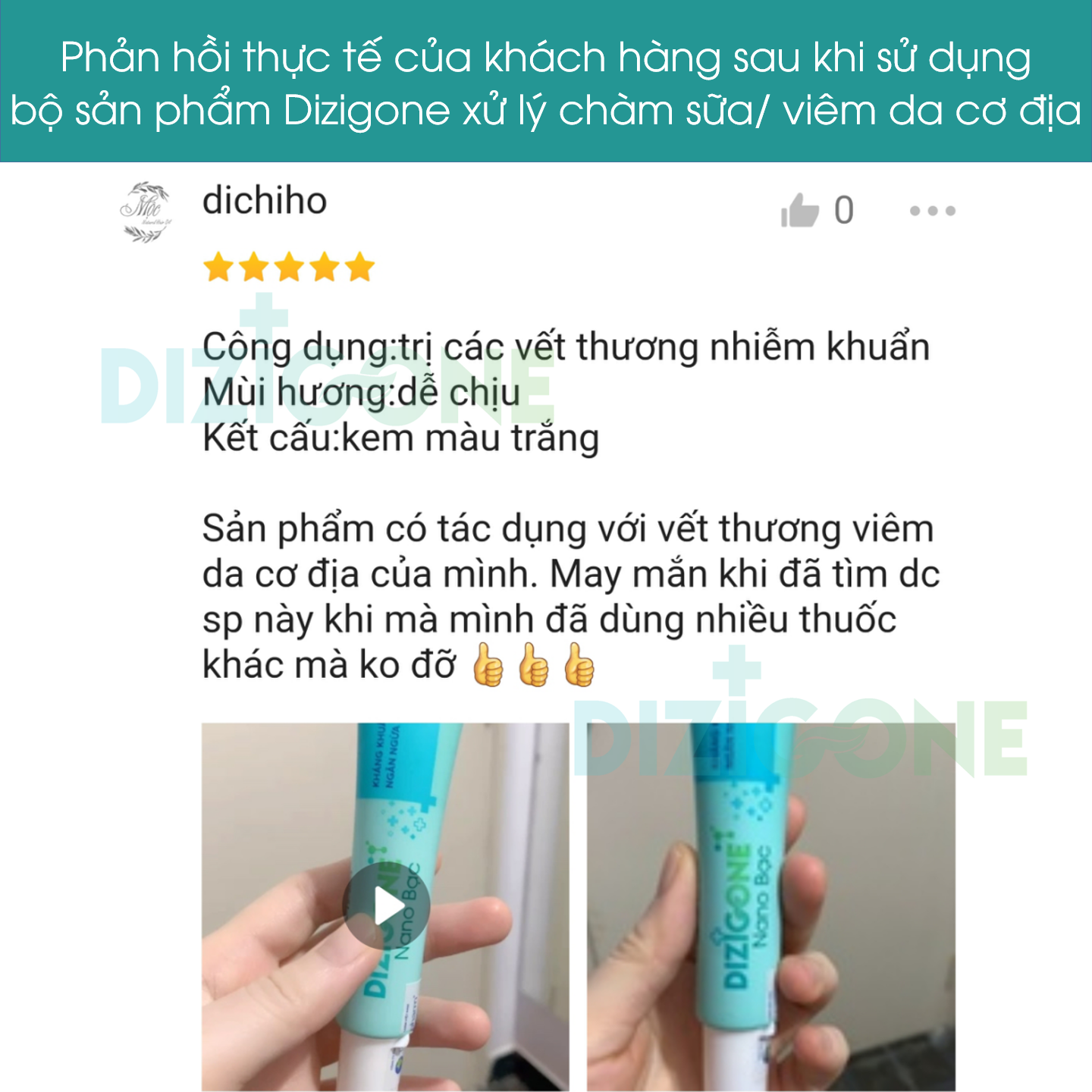 Xịt kháng khuẩn DIZIGONE chăm sóc tổn thương lành nhanh, không đau xót, tái tạo da, ngăn ngừa sẹo - 3 chai 100ml