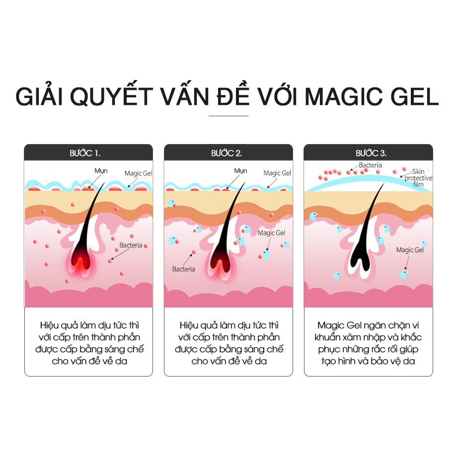 Gel hỗ trợ điều trị Mụn Ac Clear Magic Gel - The Plant Base - Loại bỏ các vấn đề về da