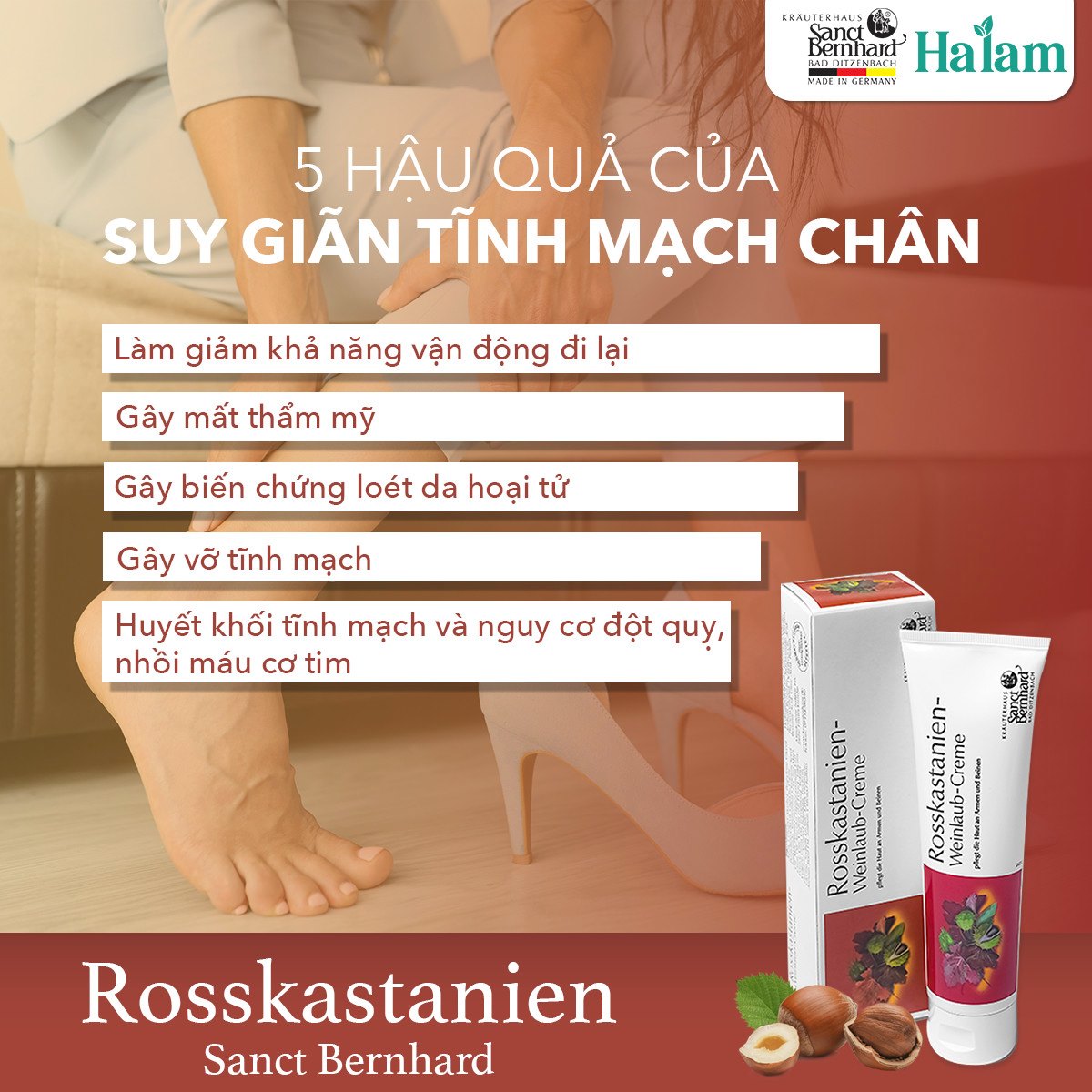 Kem bôi suy giãn tĩnh mạch chiết xuất hạt dẻ ngựa - Horse Chestnut Vine Leaf Cream (Tuýp 25ml)