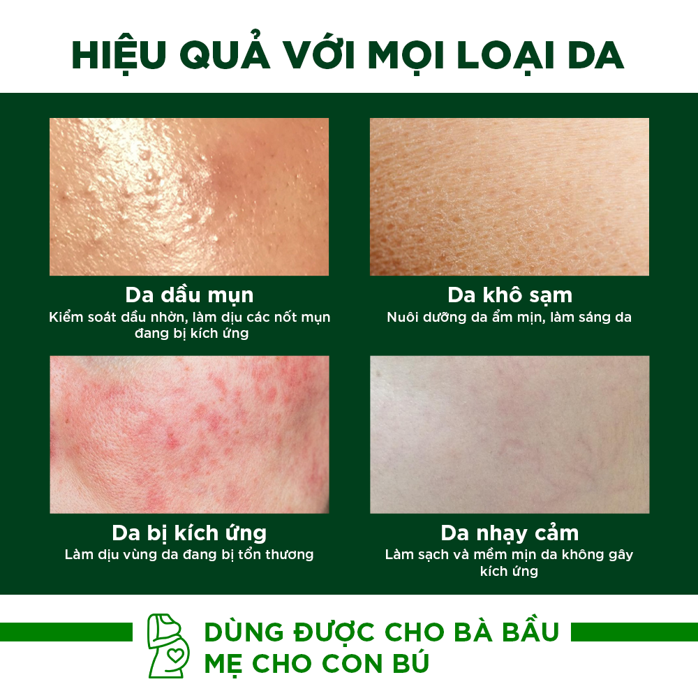 Nước Hoa Hồng Ori'be