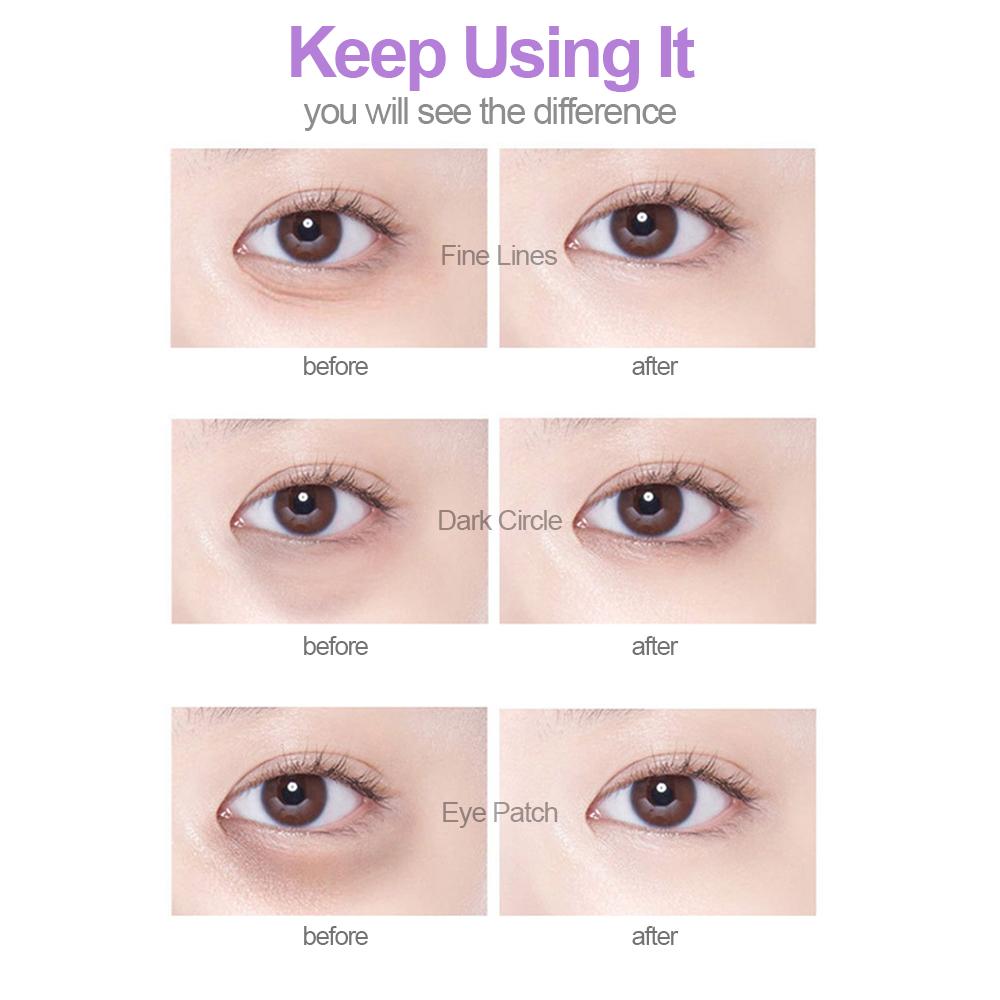 5 cặp miếng dán mắt chống lão hóa, nâng cơ giúp đôi mắt trẻ trung hơn