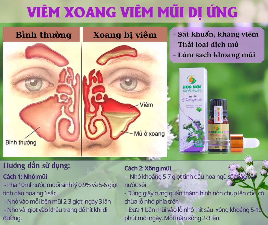 Tinh dầu hoa Ngũ sắc (cỏ hôi) nguyên chất Hoa Nén 5ml - 10ml - Đặc trị viêm xoang, viêm mũi dị ứng