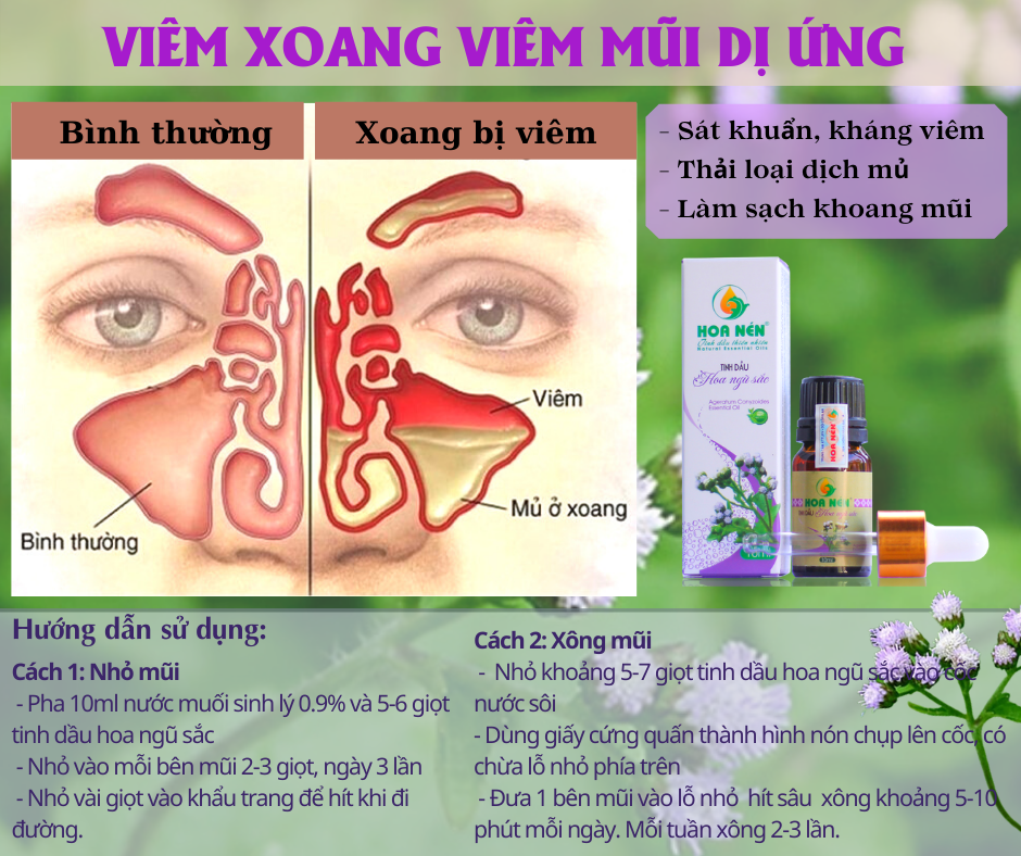 Hình ảnh Tinh dầu hoa Ngũ sắc (cỏ hôi) nguyên chất Hoa Nén 5ml - 10ml - Đặc trị viêm xoang, viêm mũi dị ứng