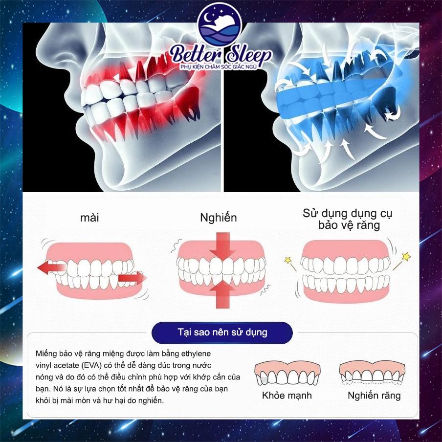 Dụng cụ chống nghiến răng bảo vệ răng 3 trong 1