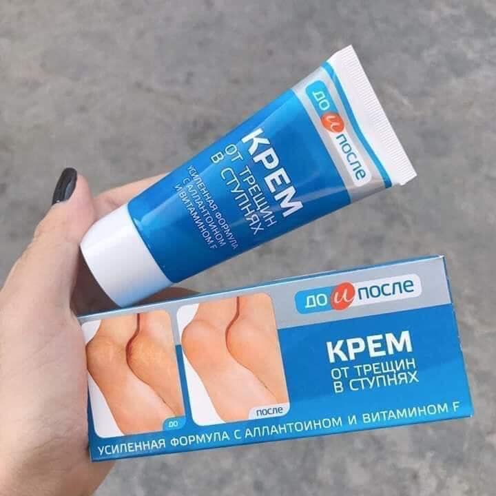 Kem giúp giảm tình trạng nứt gót chân Kpem 50ml( không xuất hóa đơn đỏ )