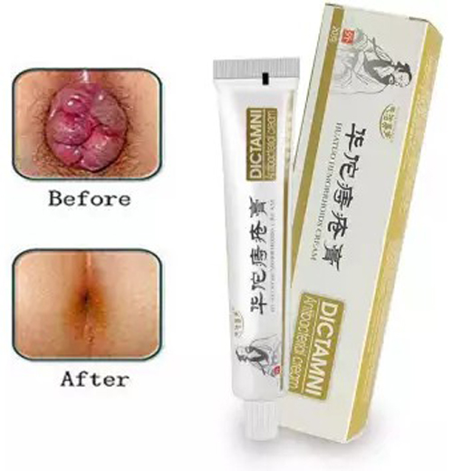 Kem Bôi Trĩ Nứt Kẽ Hậu Môn Thảo dượᴄ Authentic Hemorrhoids Chinese Herbal Cream Ointment 20g -