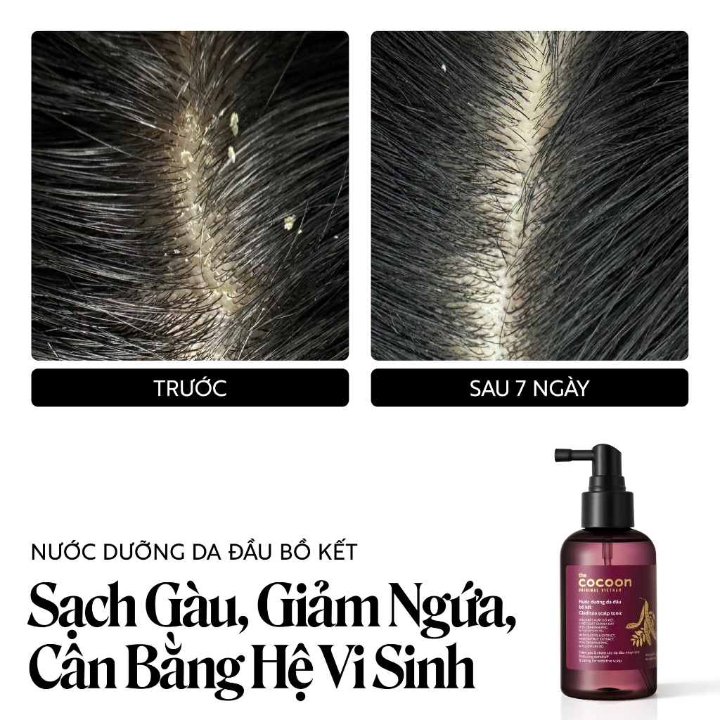 Nước dưỡng da đầu bồ kết Cocoon giảm gàu và chăm sóc da đầu nhạy cảm 140ml