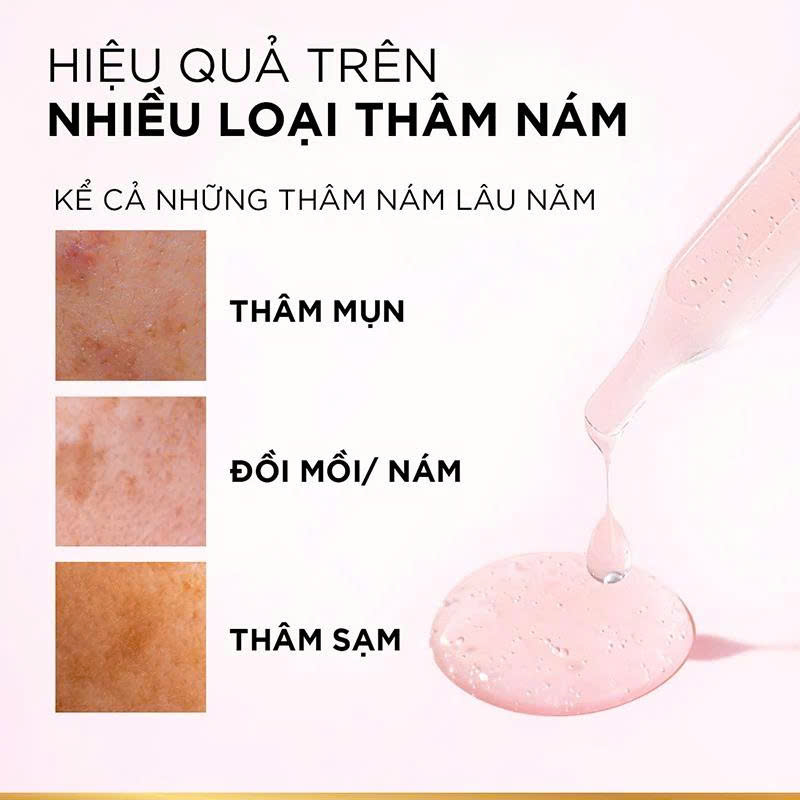 Serum L'Oreal Dưỡng Sáng Và Mờ Thâm Nám