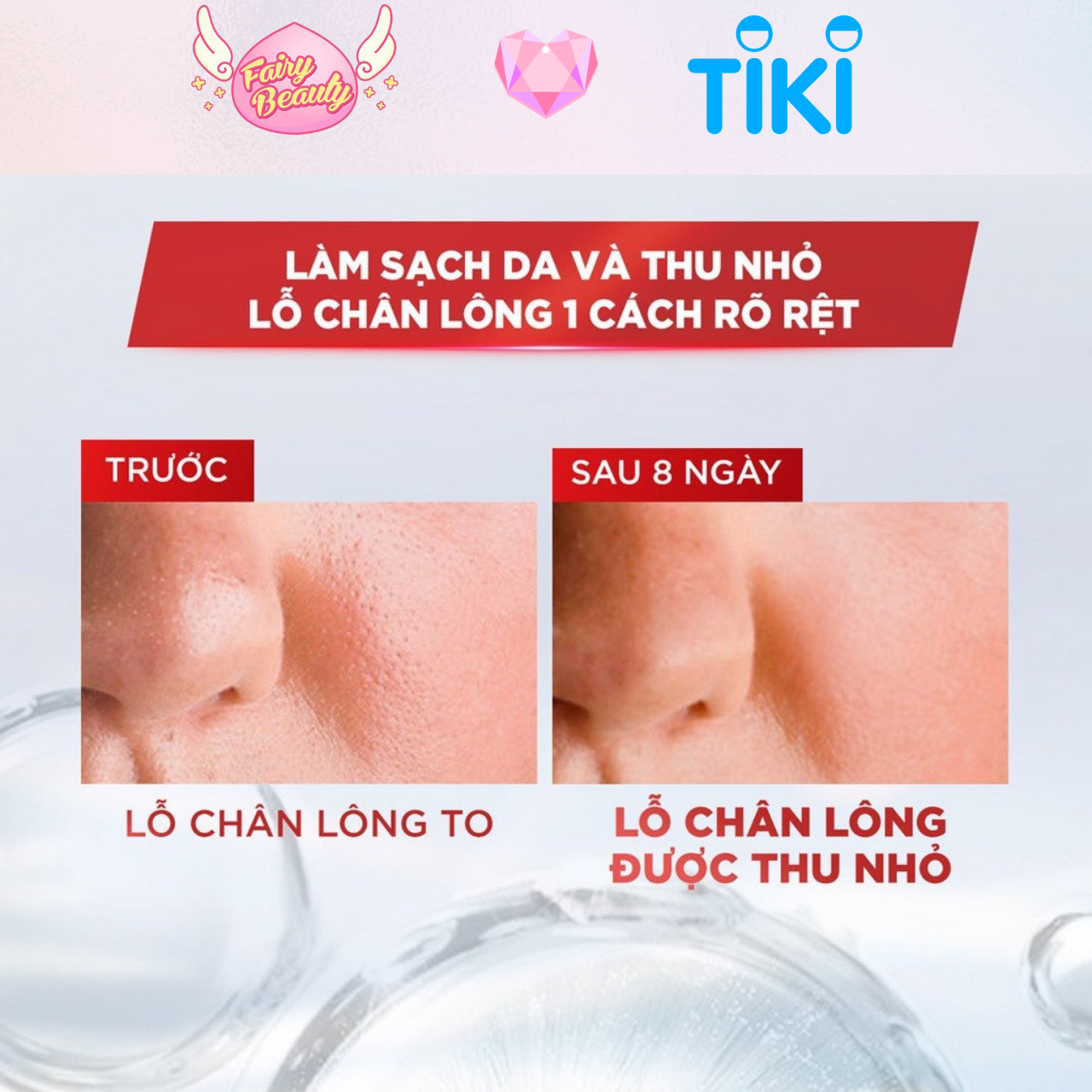 Nước Tẩy Trang Làm Sạch Chuyên Sâu Cho Da Dầu L'OREAL Revitalift Purifying Micellar Water 400/95/30ml