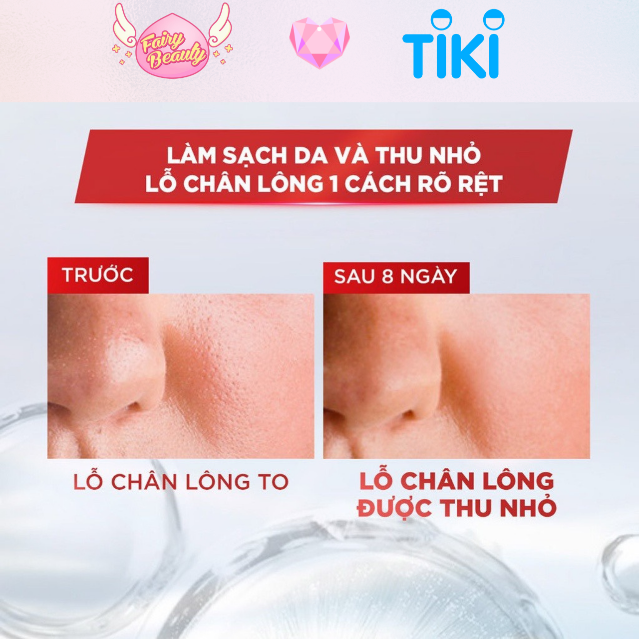 [L'OREAL PARIS] Nước Tẩy Trang Làm Sạch Chuyên Sâu Cho Da Dầu L'OREAL Revitalift  Purifying Micellar Water 400/95/30ml