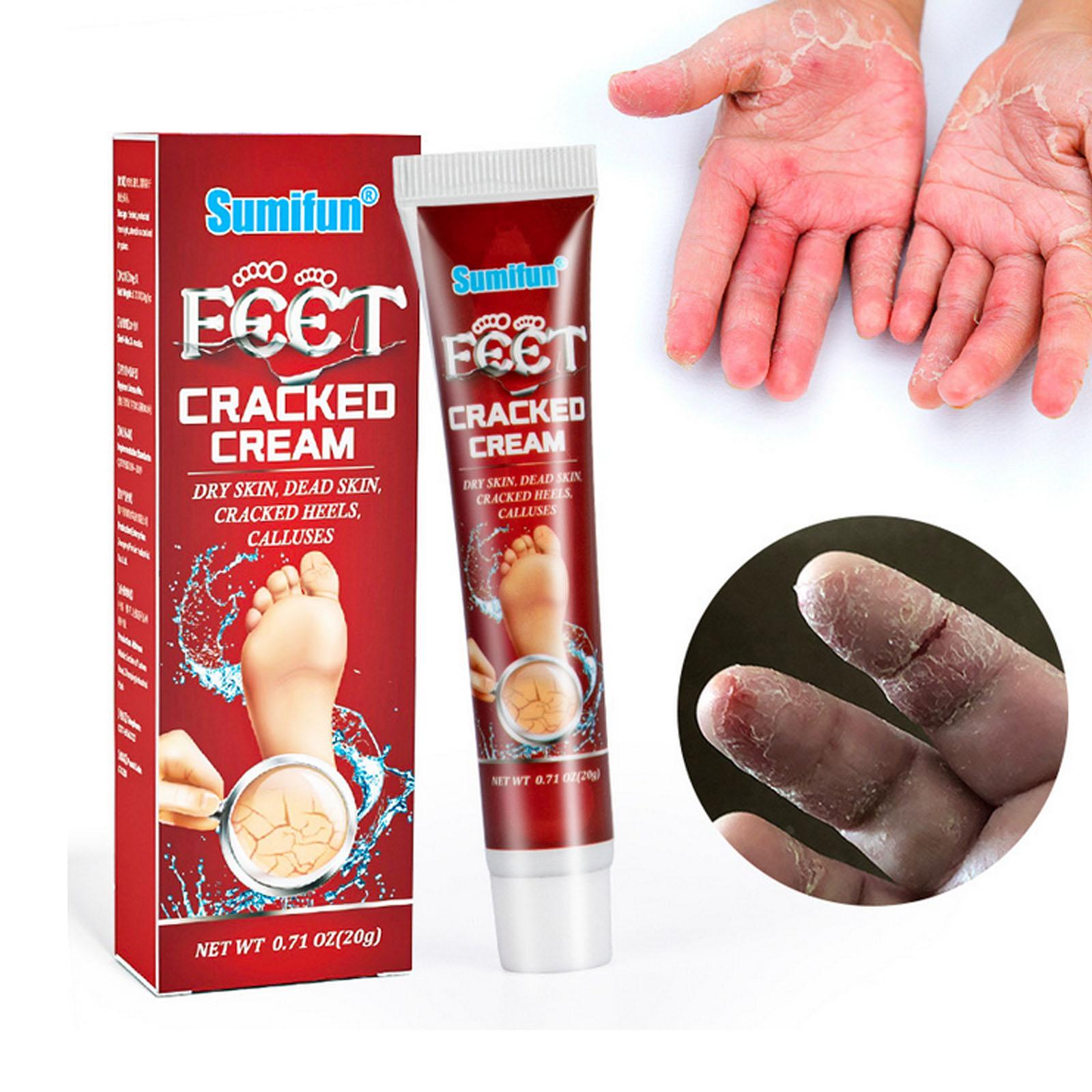 Chaps and Cracked Hands and Feet Cream Dry Crack Anti-Freeze Crack Turtle Cream
