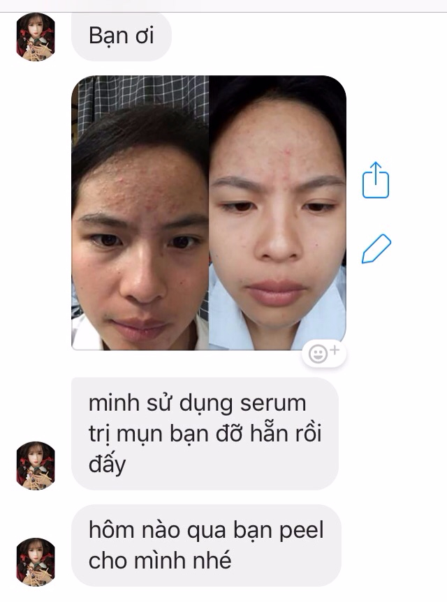 tinh-chat-tri-mun-medic-rolle-1