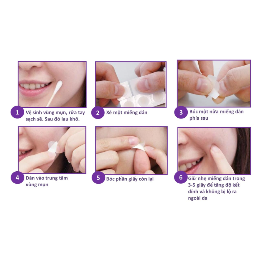 Combo 5 Miếng Dán hỗ trợ điều trị Mụn Mayancare 20 Miếng