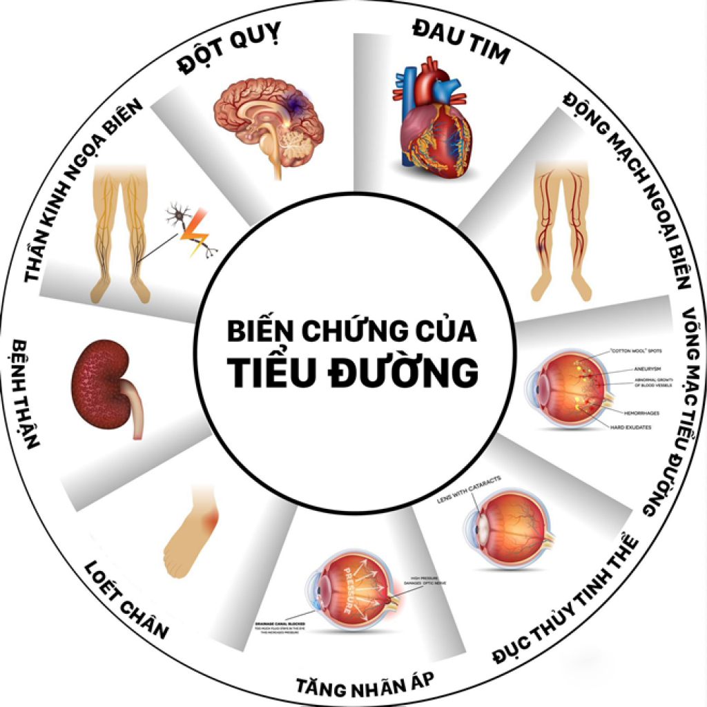 Sữa Dành Cho Người Tiểu Đường Abbott Glucerna Úc Bổ Sung Đầy Đủ Dinh Dưỡng Và Cân Bằng Đường Huyết - Lon 850g - OZ Slim Store