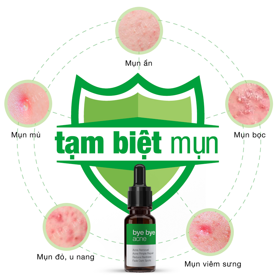 TINH CHẤT LÀM ĐẸP COLLAGEN+ TẠM BIỆT MỤN 10ml LANGCE