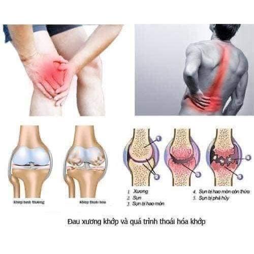 XƯƠNG KHỚP THẢO MỘC NAM CHÍNH HÃNG CỦA CÔNG TY THẢO MỘC NAM ORGANIC