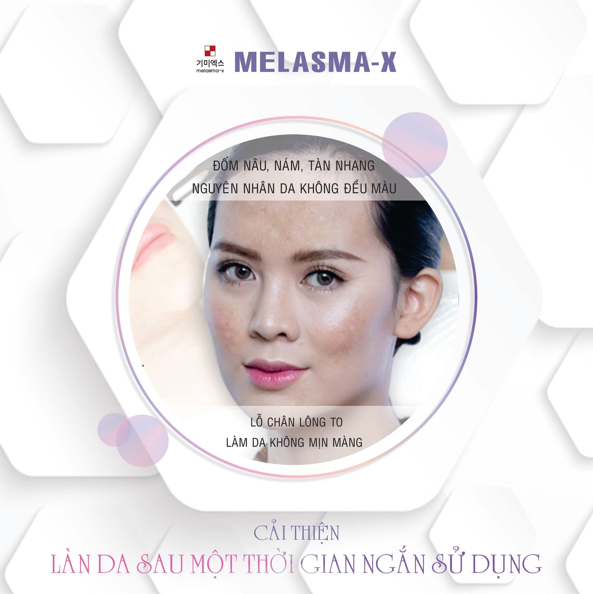 Kem Giảm Thâm Nám Và Tàn Nhang Melasma-X 3D Whitening Clinic Cream 40ml - Hàn Quốc ( Mẫu mới ) Limited