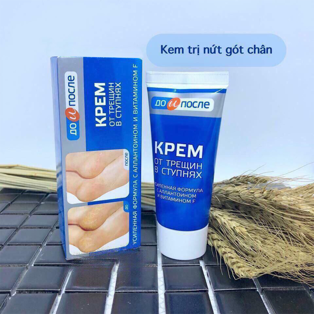 Kem Ngừa Nứt Gót Chân KPEM Dưỡng Ẩm và Làm Mềm 50ml NGA. Tặng Gel Móc Khóa 30ml