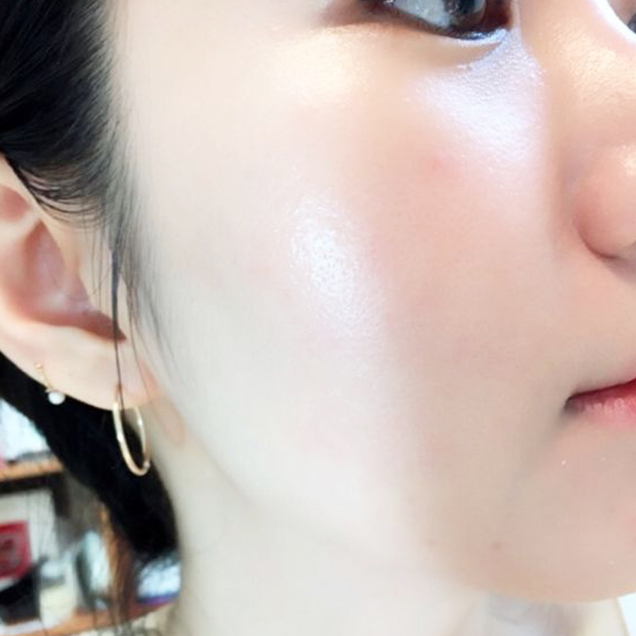 Bộ chống lão hóa, dưỡng da mặt trắng mịn, căng bóng Wonmom