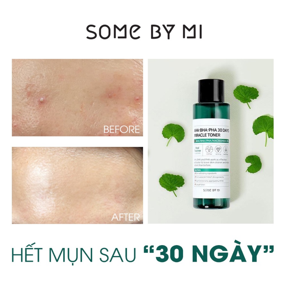 Toner Some By Mi AHA-BHA-PHA 30 Days Miracle Toner 150ml