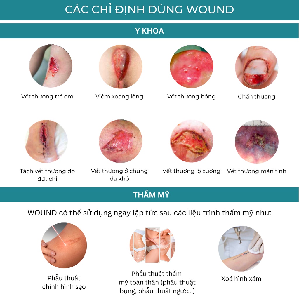Chai xịt Wound làm lành vết thương hở chưa đóng miệng, Wound ngăn ngừa sẹo sau phẫu thuật, xóa hình xăm (10ml)
