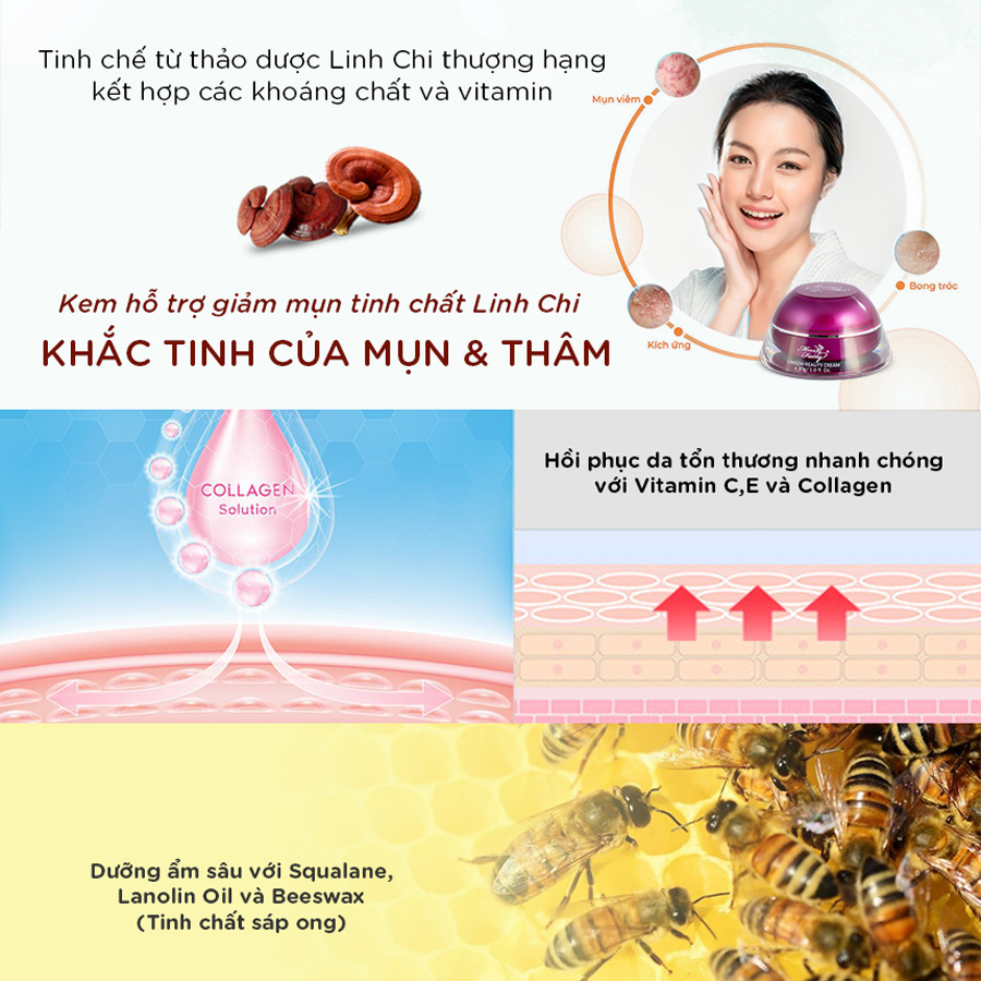 KEM MISSFAIRY LINH CHI 15g - NGĂN NGỪA MỤN - GIẢM THÂM